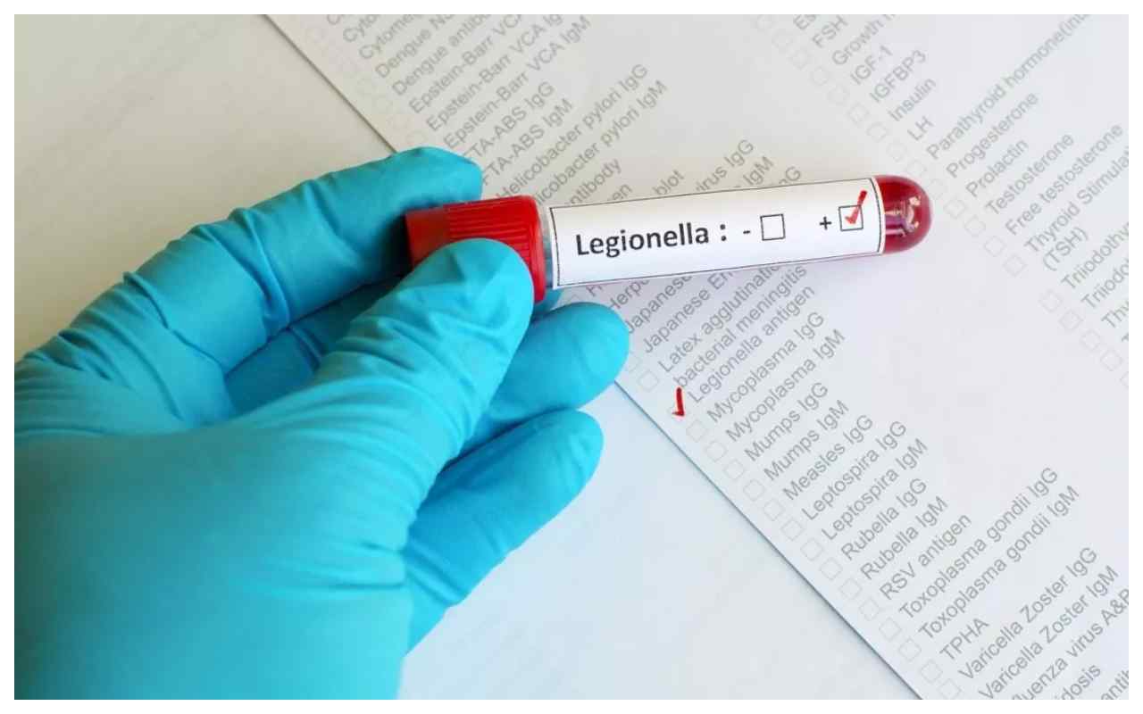 allerta legionella