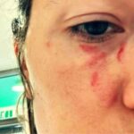 Pamela Genini, una delle foto che testimonierebbero le violenze subite