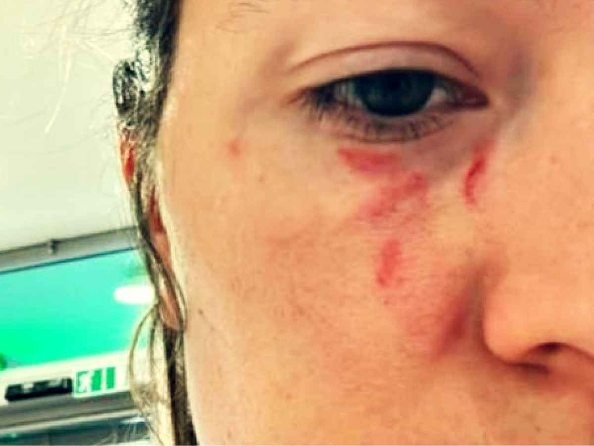 Pamela Genini, una delle foto che testimonierebbero le violenze subite
