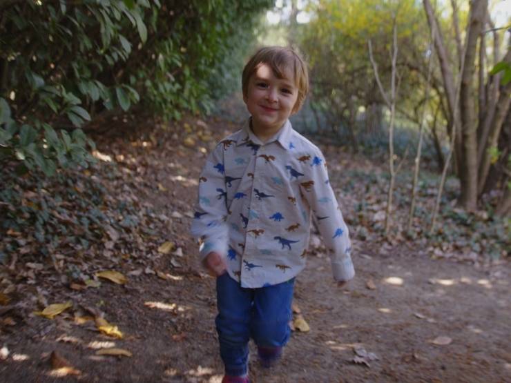 Bimbo con sindrome di Wiskott-Aldrich